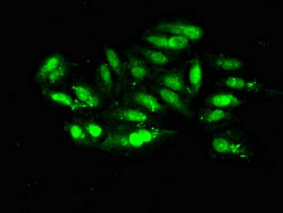 Polyclonal Rabbit anti-Human MRE11A / MRE11 Antibody (IHC, IF)