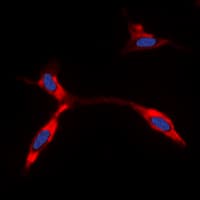 KCNJ11 / Kir6.2 Antibody (Internal)