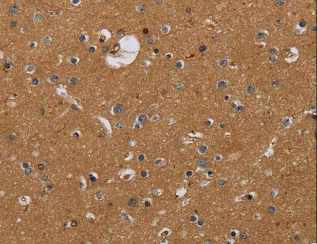 Polyclonal Rabbit anti-Human Glucocorticoid Receptor Beta Antibody (IHC)