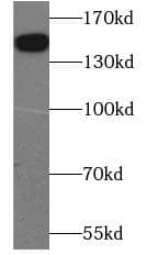 THBS2 / Thrombospondin 2 Antibody