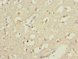 Polyclonal Rabbit anti-Human CYP4B1 Antibody (IHC)