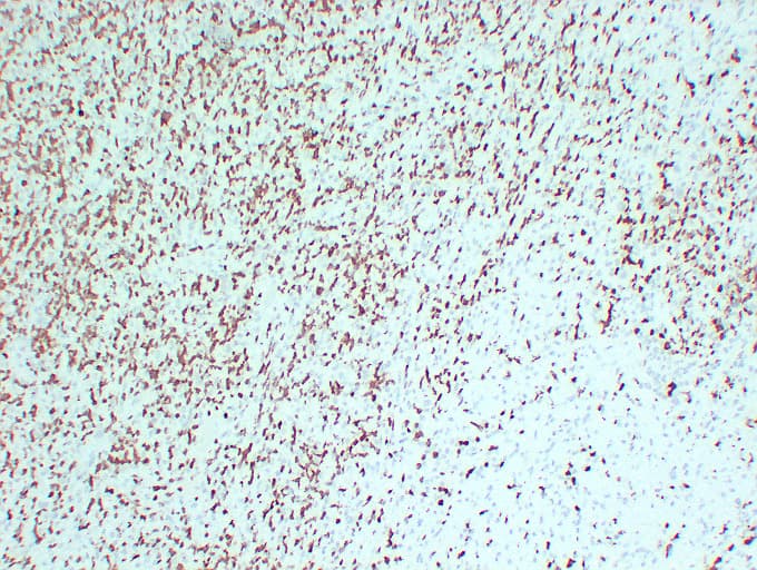 ZAP70 Antibody (clone ABT-ZAP70)