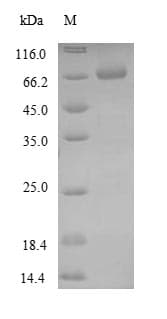 Zebrafish GFAP Protein (Recombinant 10His-SUMO, N-terminus + Myc, C-terminus)
