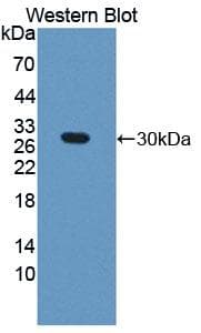GAMT Antibody (aa2-236, Biotin)
