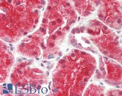 Polyclonal Rabbit anti-Human NIT2 Antibody (aa72-121, IHC, WB)