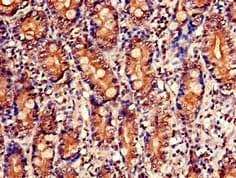 Polyclonal Rabbit anti-Human NUDT1 / MTH1 Antibody (IHC, IF)
