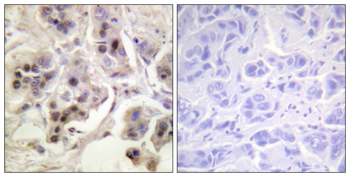 MAPKAPK2 / MAPKAP Kinase 2 Antibody (p334)