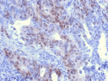 RAD51 / RECA Antibody (clone RAD51/2701)