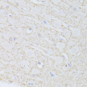 PHGDH Antibody