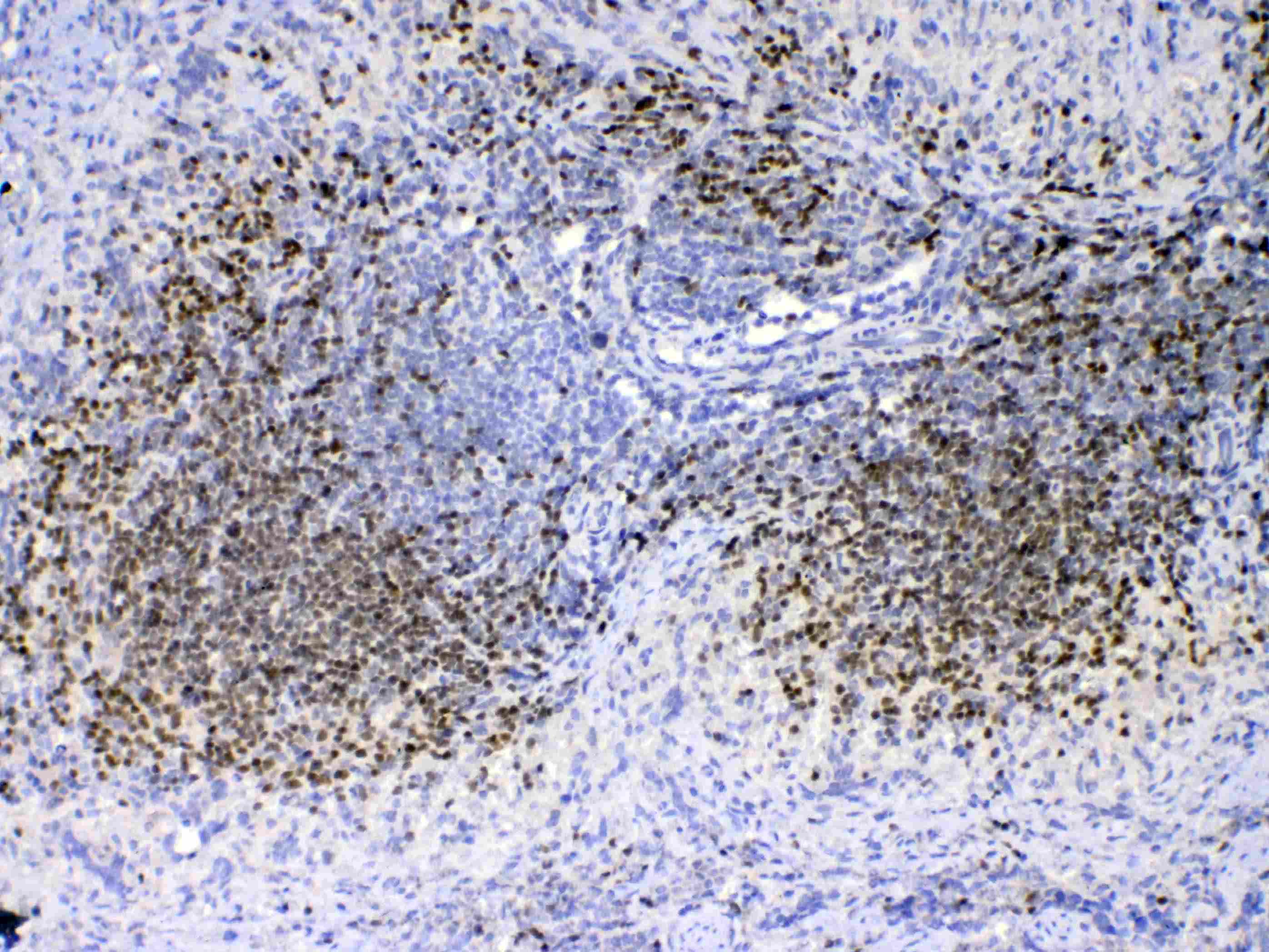 Polyclonal Rabbit anti-Human PAX5 Antibody (IHC, WB)