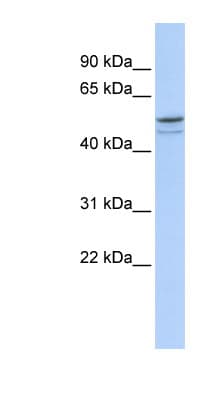 Polyclonal Rabbit anti-Human DMRTA1 Antibody (aa179-228, WB)