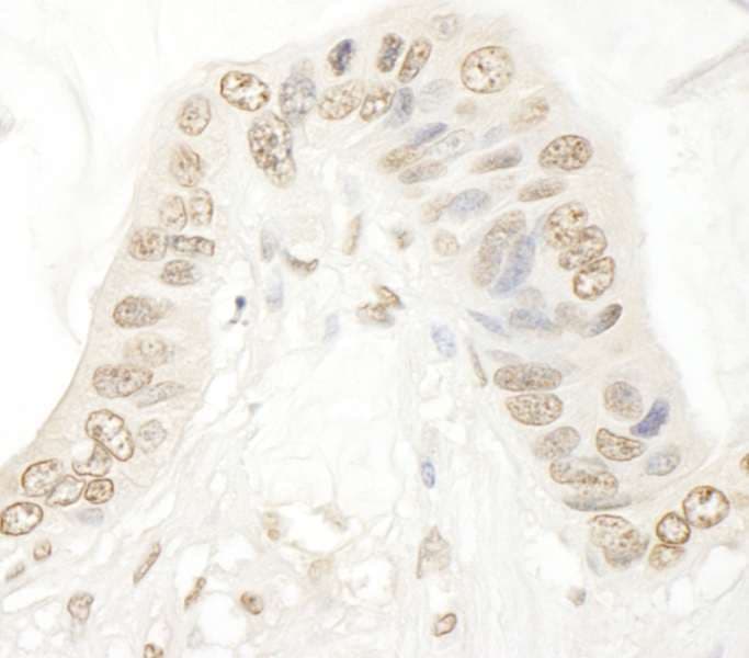 SMG9 Antibody (aa75-125)