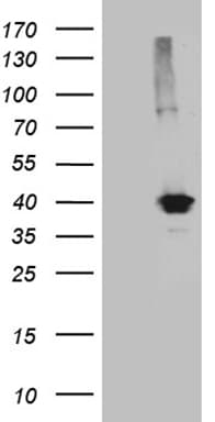 KLF7 Antibody (clone OTI1A7)
