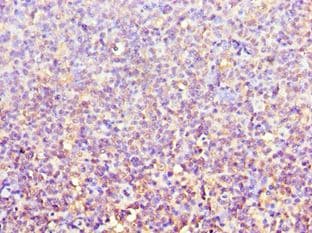 ACTR3B / ARP4 Antibody (aa189-418)
