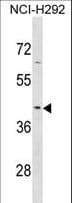 Polyclonal Rabbit anti-Human SERPINB9 / PI9 Antibody (aa122-150, IHC, WB)