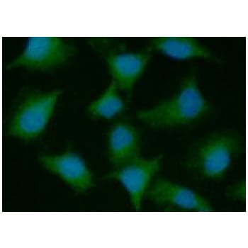 PSMD10 / Gankyrin Antibody (clone AT1F4)