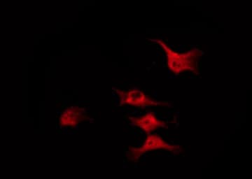 CFL1 / Cofilin Antibody (phospho-Ser3)