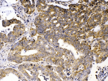 GAD65 Antibody