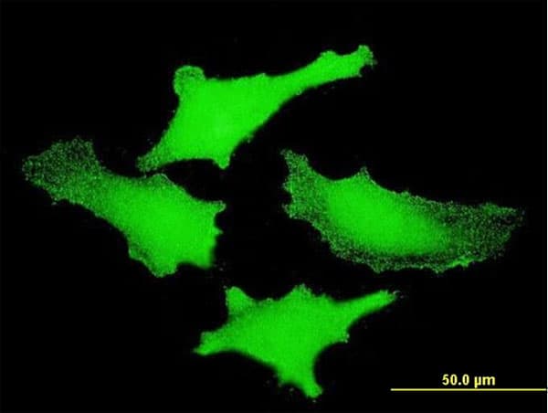 IHC-plus™ PIM1 / Pim-1 Antibody (clone 3F5)