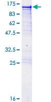 Human AARS Protein (Recombinant GST)