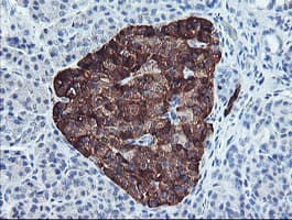 PPP1R15A / GADD34 Antibody (clone OTI1E1)
