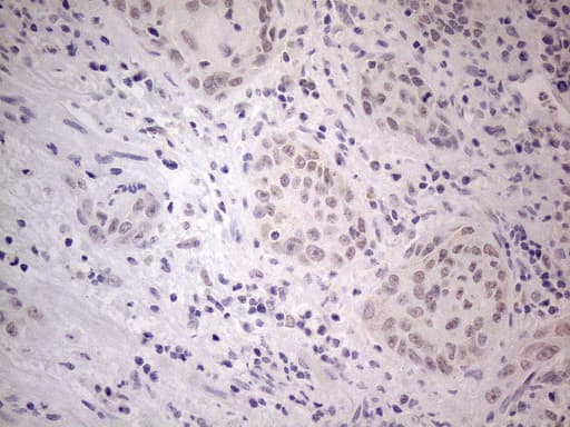 IRS1 Antibody (aa1-280, clone OTI2B10)