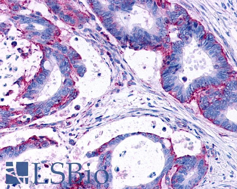 PathPlus™ Polyclonal Rabbit anti-Human LPAR3 / LPA3 / EDG7 Antibody (Cytoplasmic Domain, IHC)