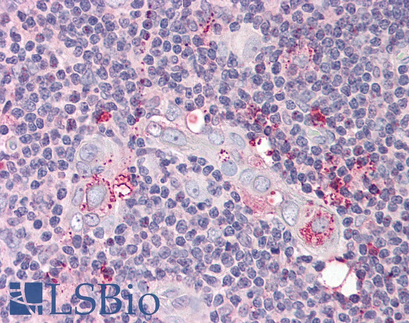 IHC-plus™ TP53AIP1 / p53 AIP1 Antibody