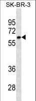 CYP1A2 Antibody (aa255-282)