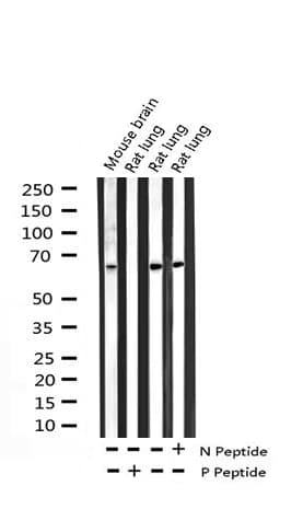 Polyclonal Rabbit anti-Human RELA / NFKB p65 Antibody (phospho-Thr254, IHC, IF, WB)