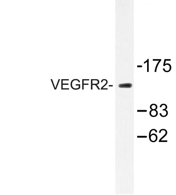 KDR / VEGFR2 / FLK1 Antibody (Gln1169)