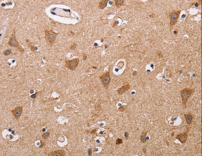 ALG9 Antibody
