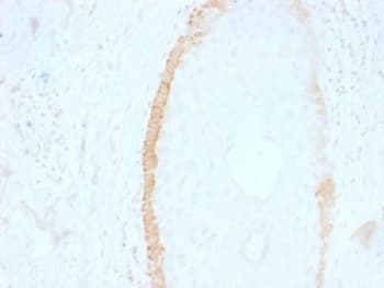 KRT15 / CK15 / Cytokeratin 15 Antibody (clone SPM190, Azide-free, BSA-free)