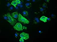 RASSF1 / RASSF1A Antibody (clone OTI2A9)