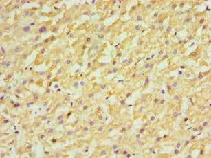 IHC-plus™ FDFT1 / Squalene Synthase Antibody (aa1-260)
