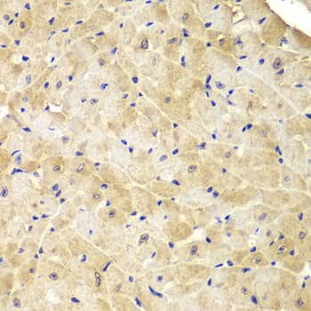 Polyclonal Rabbit anti-Human IDH1 / IDH Antibody (IHC, IF, WB)