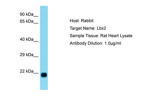 Polyclonal Rabbit anti-Rat LBX2 Antibody (C-Terminus, WB)