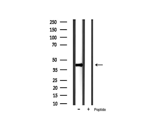NFKBIA / IKB Alpha / IKBA Antibody