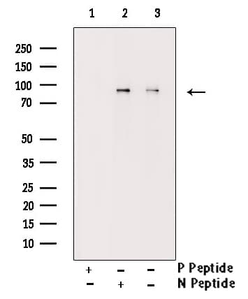 GYS1 / Glycogen Synthase Antibody (phospho-Ser645)