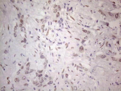 TLK2 Antibody (aa1-296, clone OTI2D10)
