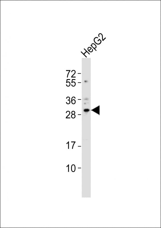 Polyclonal Rabbit anti-Human CBX7 Antibody (aa168-201, WB)