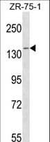PAN2 / USP52 Antibody (aa860-888)