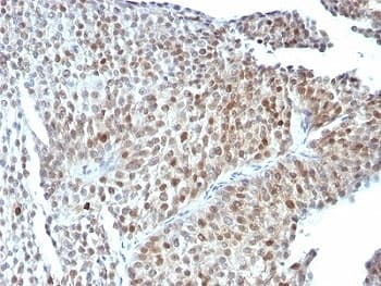 TP53 / p53 Antibody (clone SPM589)