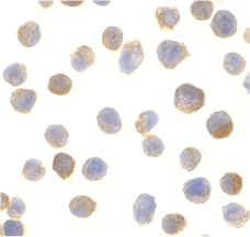 C1QTNF2 / CTRP2 Antibody
