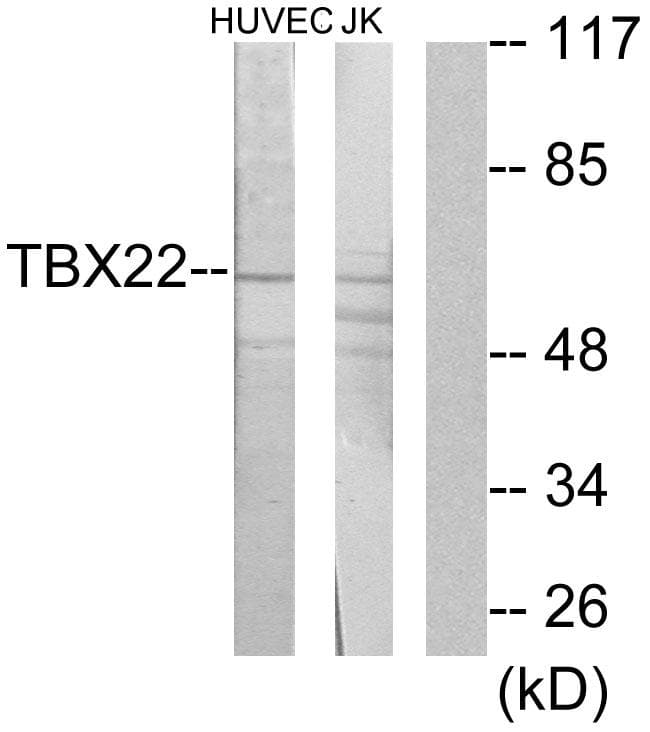 Polyclonal Rabbit anti-Human TBX22 Antibody (WB)