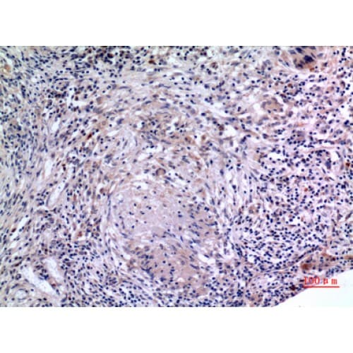 IL6 / Interleukin 6 Antibody (Internal)