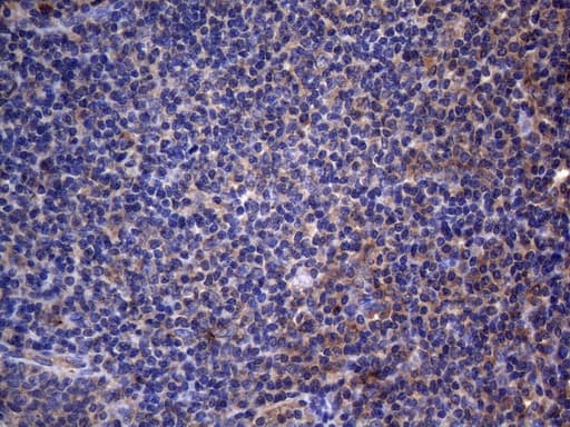 CRP / C-Reactive Protein Antibody (clone OTI4B4, Carrier-free)