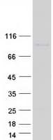 Human JPH4 Protein (Recombinant Myc-DDK (Flag))