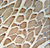 Polyclonal Rabbit anti-Human GBAS Antibody (aa130-159, IHC, WB)