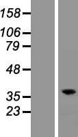 RASSF2 Protein (Over-Expression Lysate Myc-DDK (Flag))